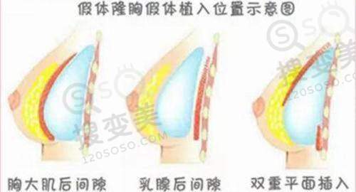 太原华美整形医院的团队技术亮点