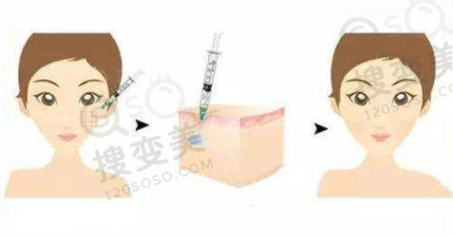 上海大麦微针植发医院特色技术揭秘