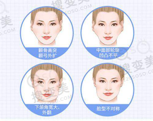 广州海峡整形的医生团队