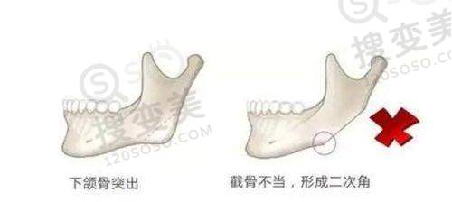 杭州整形医院是正规医院吗——价格合理性与透明性