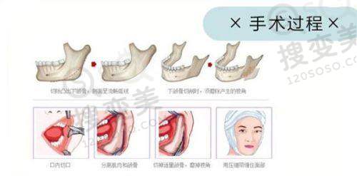 美冠塔中老年口腔医院怎么样?——收费标准