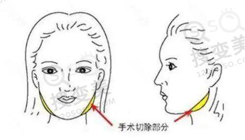 张年翁医生收费价格：
