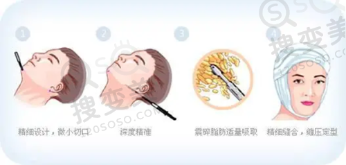眼科询问在线:三家眼科机构的预约方式