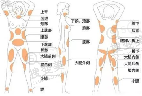 重庆骑士医院是正规医院吗——大脚骨矫正实力的展现