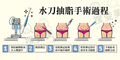 泰国整形医院在线询问:注意事项与建议