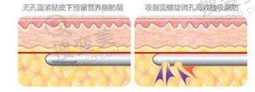 2024牙博士口腔价目表 - 牙齿矫正项目收费