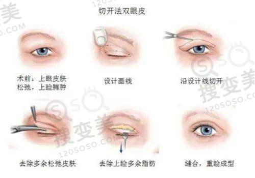 美冠塔口腔套筒冠义齿的医生团队实力