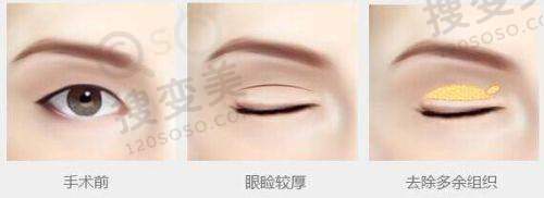 美奥口腔2025年儿童齿科及牙冠收费标准
