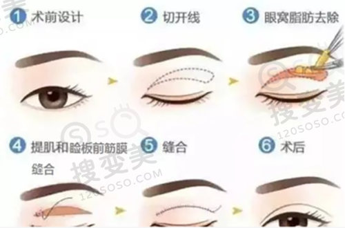 成都成美之鼻眼修复特色