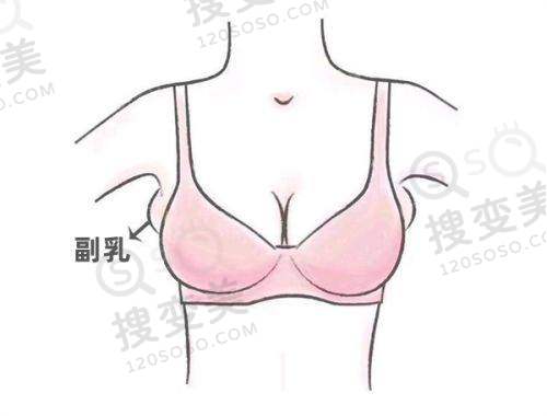 2025 年山西爱尔眼科医院近视手术价格表