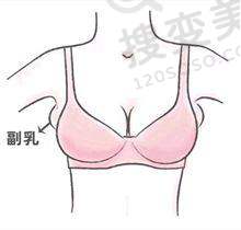 赤峰市朝聚眼科医院的收费情况