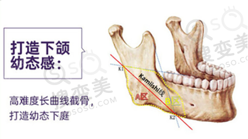 刘学宝医生口碑评价及真人实例