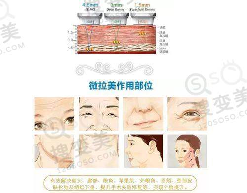 老人全口假牙价目表之半口假牙价格