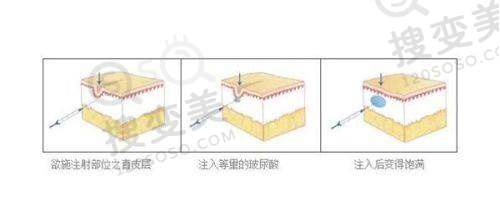 什么型的B更好?——总结与建议