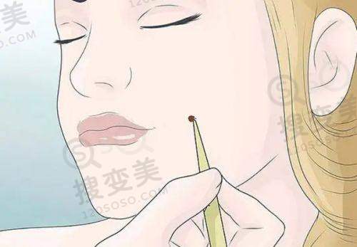 东莞知美整形医院如何？医生技术优项目多，收费透明口碑好值得选 