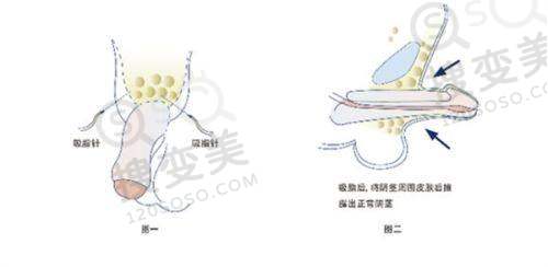 赤峰市朝聚眼科医院的口碑与服务