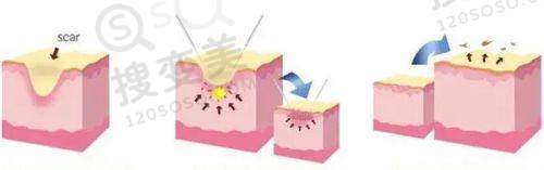 眼科骨干医生在线:北京同仁眼科骨干医生服务