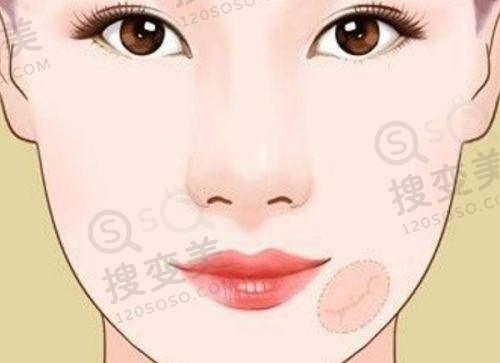 宁波尚丽整形口碑如何？中韩医师团队技术强，顾客满意度超90% 