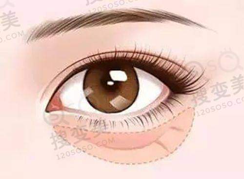 眼科骨干医生在线:华 西眼科询问与预约攻略