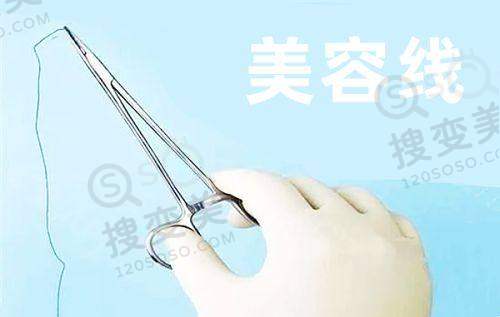 2025 年北京爱尔眼科医院近视手术价格表