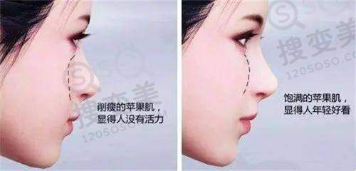 2025年国内各地正规医院OK镜价格对比