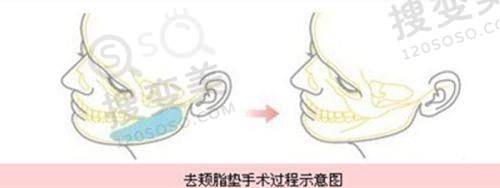 眼科骨干医生在线问诊:北京同仁医院的医生实力