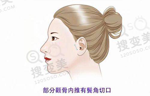 王杨医生预约挂号