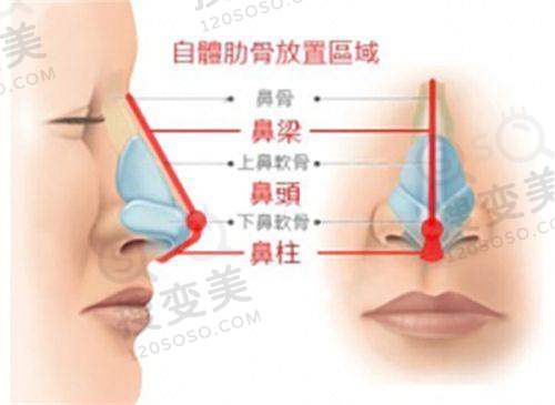 双眼皮修复哪里做的更好之师丽丽医生与北京丰联丽格医疗美容门诊部