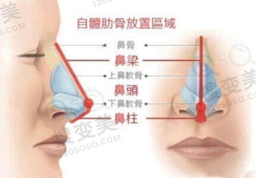 牙龈出血要警惕三种病之日常护理与预防措施
