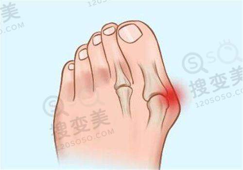 宋跃医生技术优势