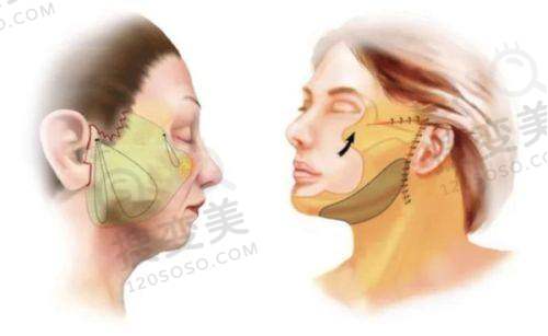 徐军 医生口碑评价及真人实例