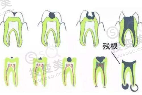 刘丹虹医生口碑评价及真人实例