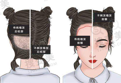 武兴肖院长技术优势