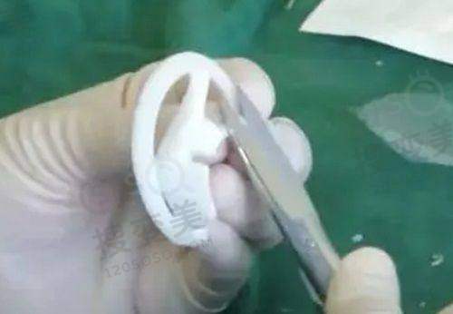 崔昌墉院长擅长项目