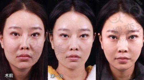 商奕医生擅长项目