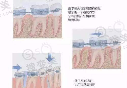 袁小栖院长技术优势