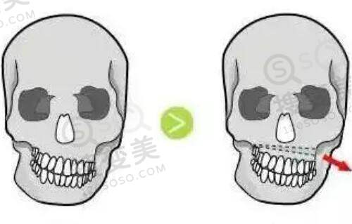 史景辉医生口碑评价及真人实例