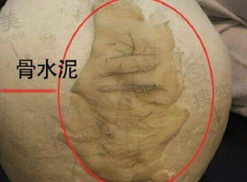 陈军院长坐诊医院