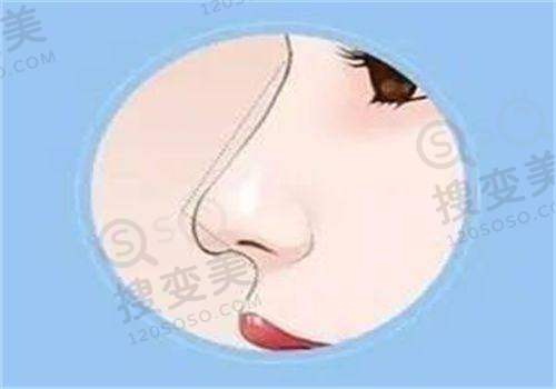 刘丹虹医生技术优势