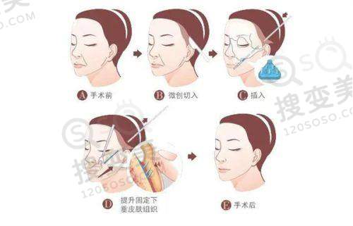 王明医生技术优势