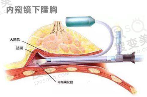 孟庆鹏院长技术优势
