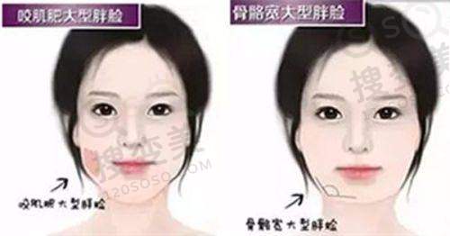 黄凯医生价格表