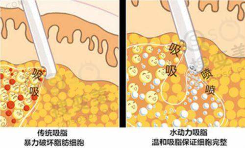 深圳美莱医疗美容医院 - 深圳受欢迎的整容医院