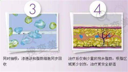 马进医生价格表