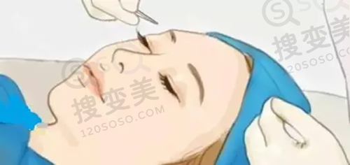 王俊玉医生口碑评价及真人实例