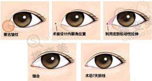舒英医生预约挂号