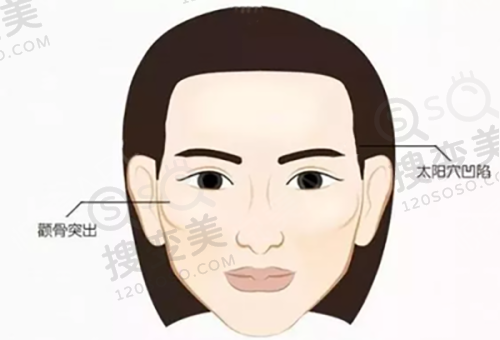 舒英医生擅长项目