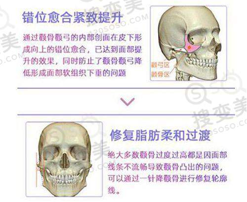 张磊医生口碑评价及真人实例