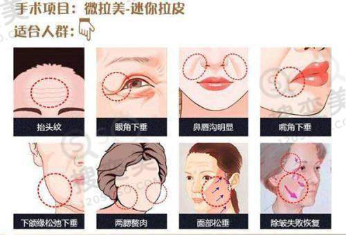刘丽英医生预约挂号