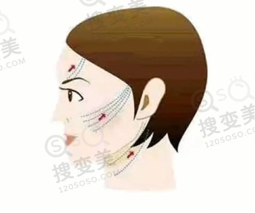 整形美容医院 - 深圳正规的整容医院